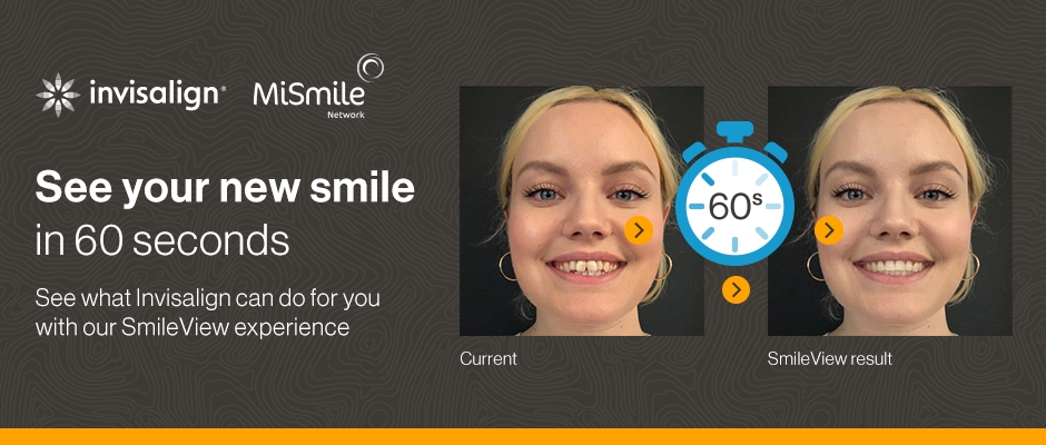 smile view invisalign